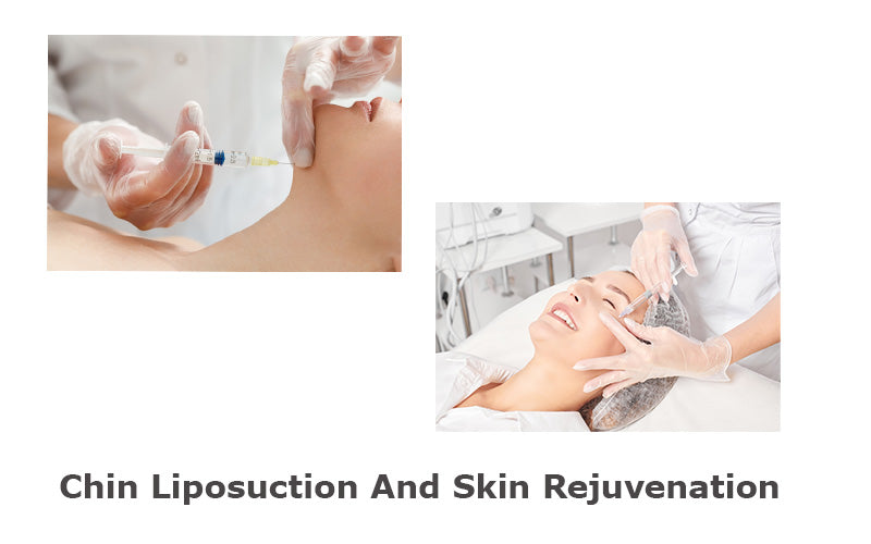 Chin Liposuction And Skin Rejuvenation