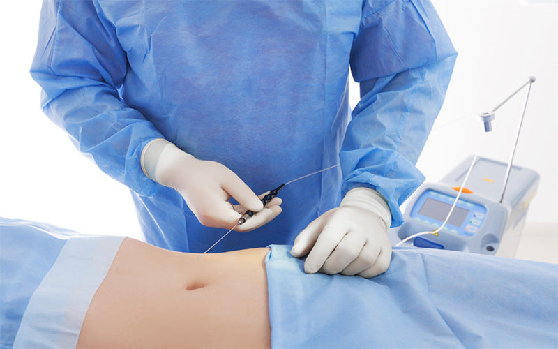 Liposuction Recovery Tips