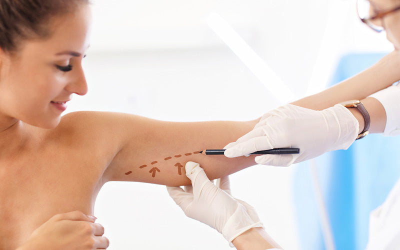 Non-Surgical Alternatives To Arm Lift Surgery