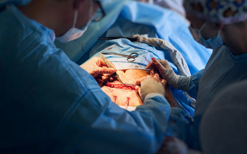 How Long Does Tummy Tuck Surgery Take To Heal?