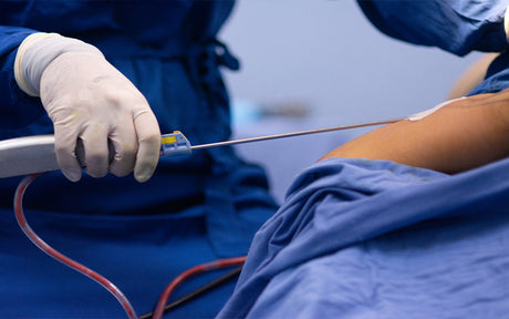 How To Get Rid Of Fluid Pockets After Liposuction: Effective Post-Surgery Techniques