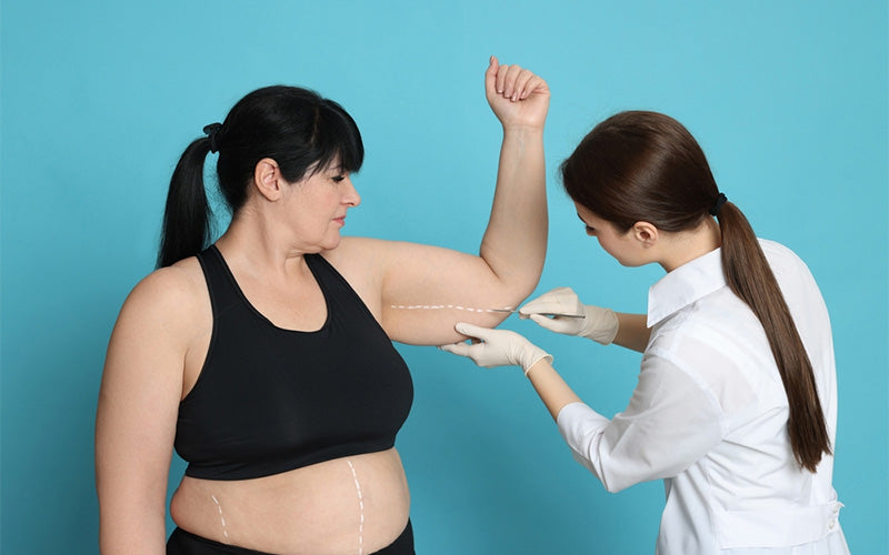 Is Arm Liposuction Worth It? 