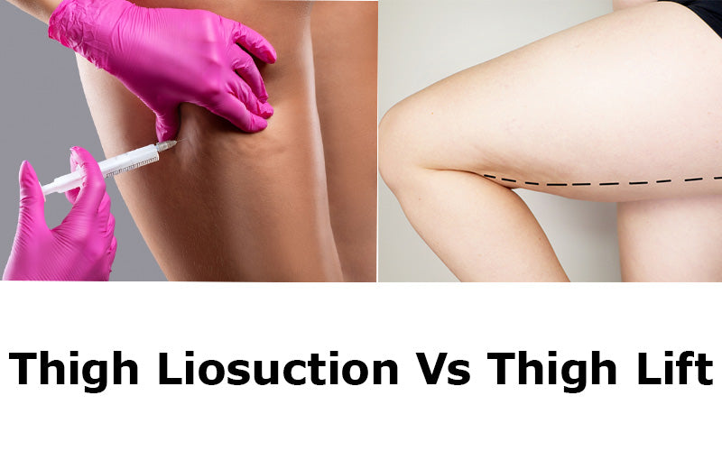 Thigh Liposuction Vs Thigh Lift