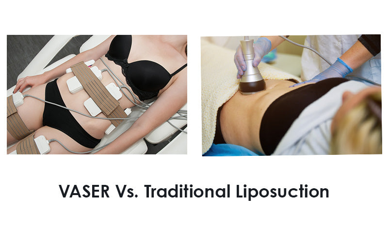 VASER Vs. Traditional Liposuction: Which Is Better For Me?