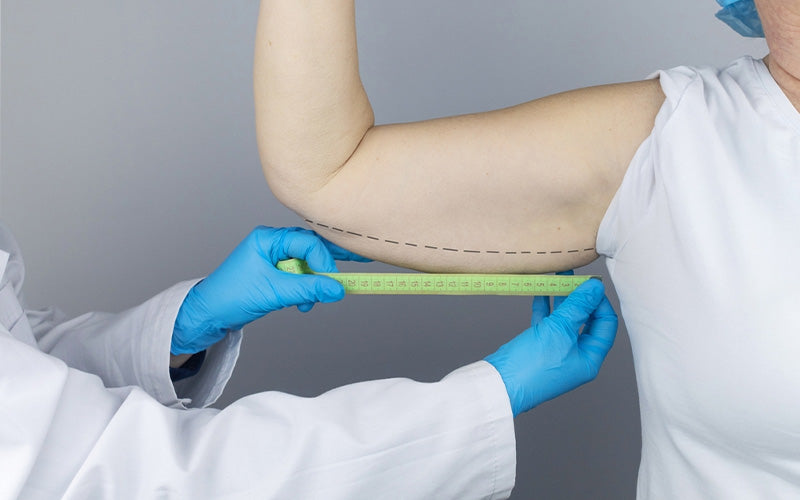 How Long Does A Brachioplasty Take To Heal